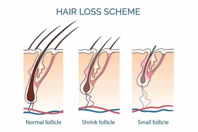 Schematic diagram of hair loss (promotion of minoxidil) Schematic diagram of hair loss (promotion of minoxidil)