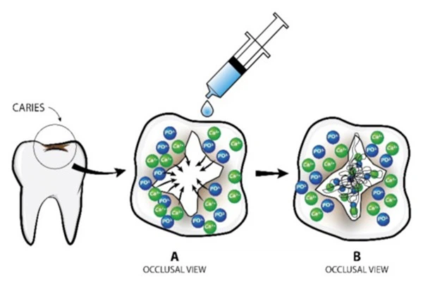 Oligopeptide P11-4 The role of Peptide Oligopeptide P11-4 The role of Peptide