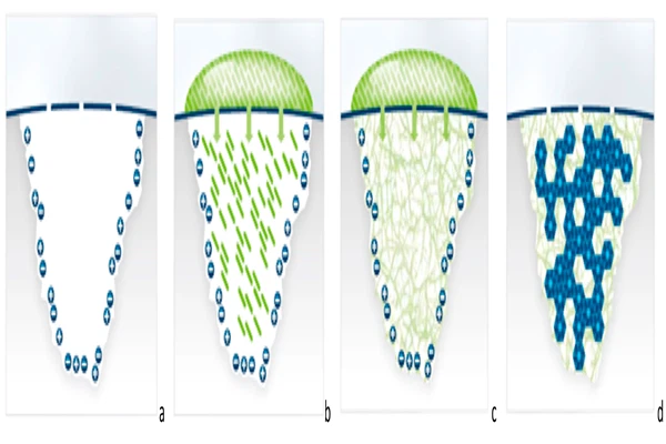 Biomimetic Enamel Regeneration Using Self-Assembling Peptide P11-4 Biomimetic Enamel Regeneration Using Self-Assembling Peptide P11-4