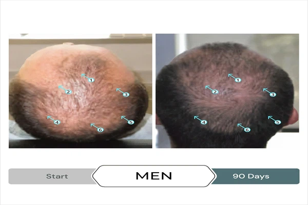 Astressin-B has significant effects. Astressin-B has significant effects.
